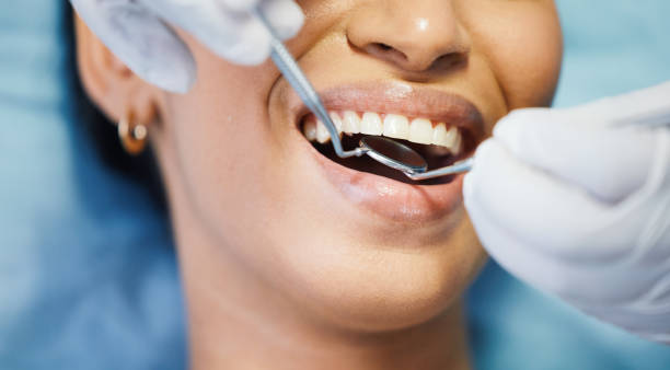 Best Emergency Dentist for Lost Fillings or Crowns in Scott City, MO