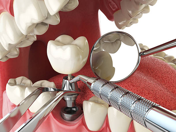 Best Emergency Cosmetic Dentistry in Scott City, MO